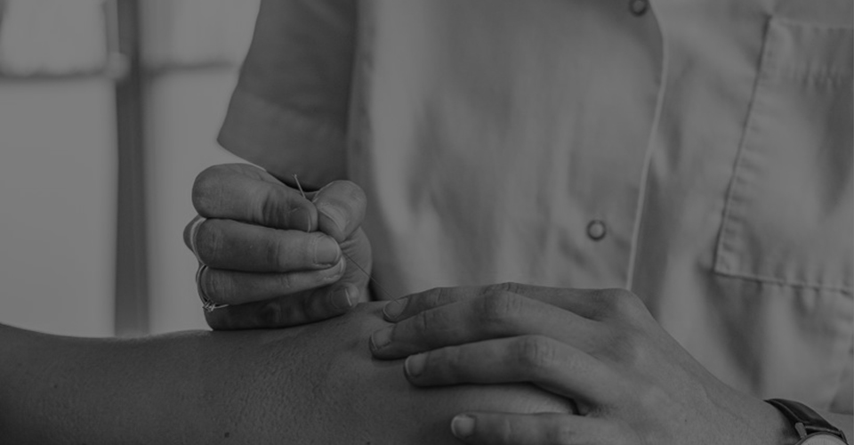 Myofasciale therapie